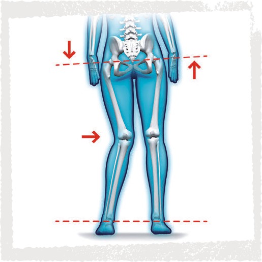 Haltungsanalyse - anatomische/funktionelle Beinlängendifferenzen